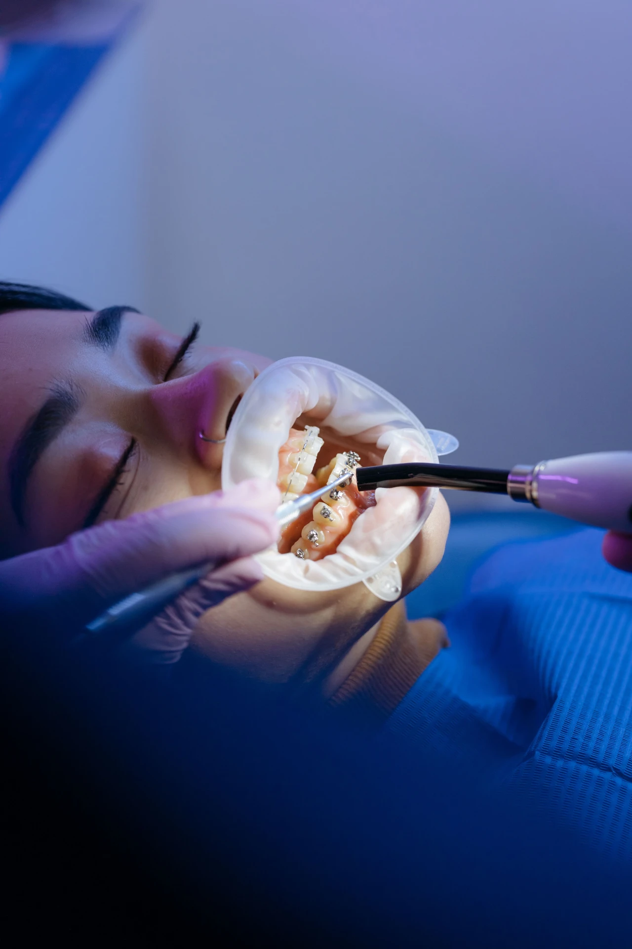 Braces & Clear Aligners
